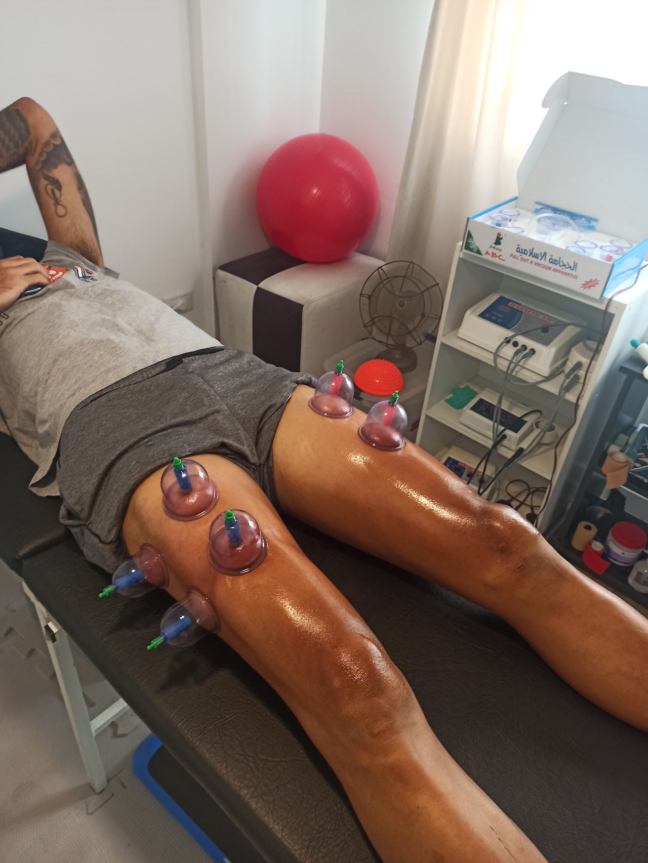 Sesión de tratamiento con ventosas